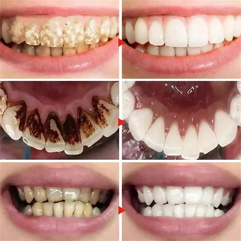 Outil de nettoyage buccal 5D pour l'hygiène, nouveau dentifrice blanchissant les dents, pour une haleine fraîche et des soins dentaires.
