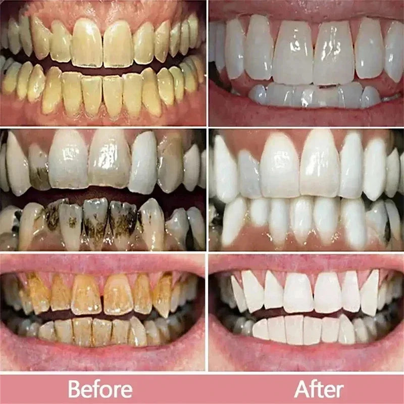 Outil de nettoyage buccal 5D pour l'hygiène, nouveau dentifrice blanchissant les dents, pour une haleine fraîche et des soins dentaires.