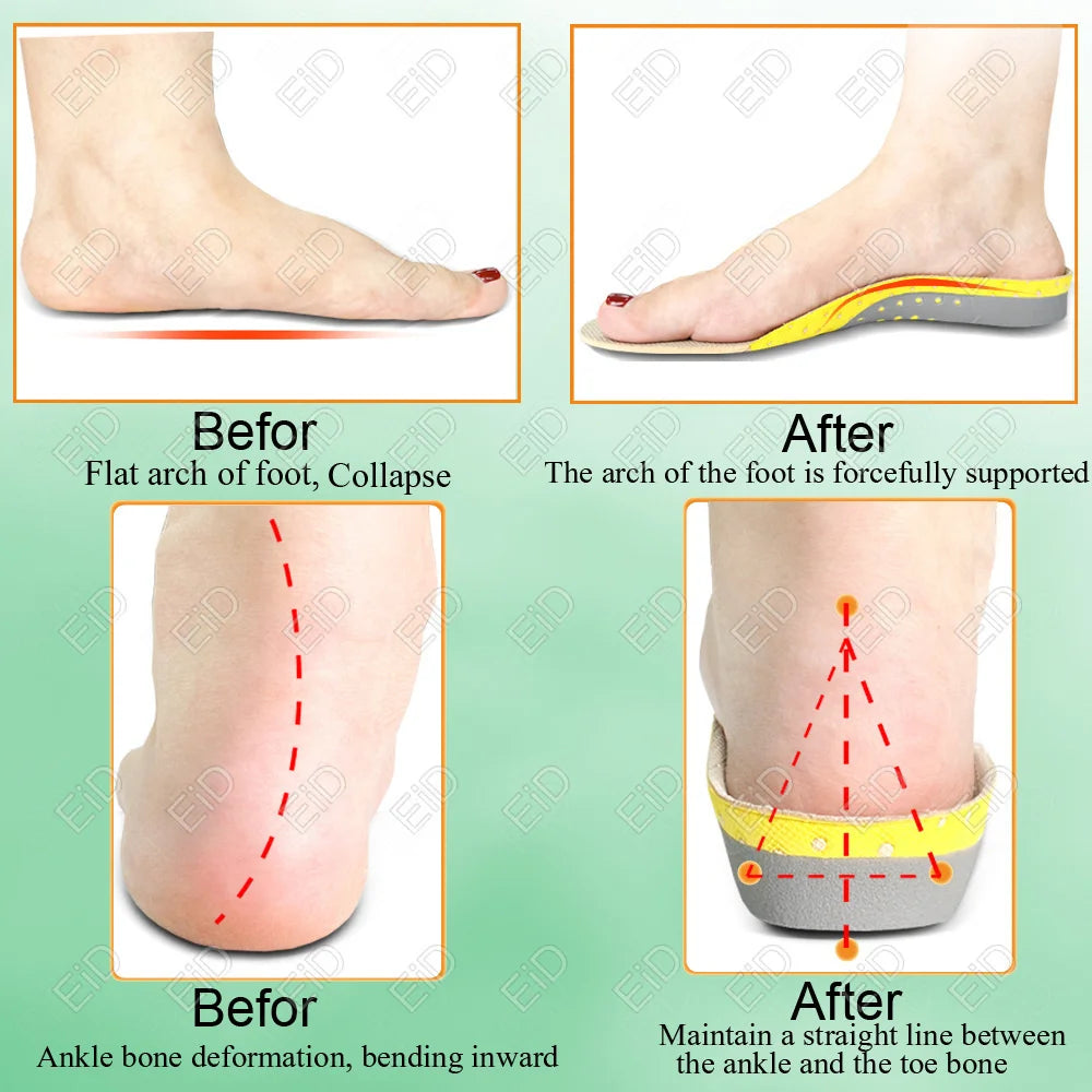 Semelles orthopédiques en gel de qualité supérieure unisexe, pied plat 4WD, semelle de santé pour chaussures, insertion de coussin de soutien de la voûte plantaire pour fasciite plantaire