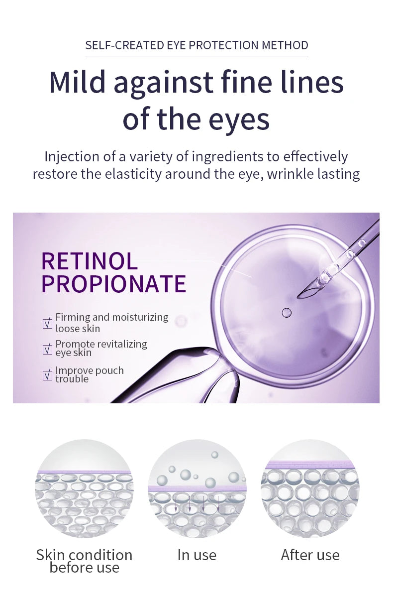 O'CHEAL Anti-rides Anti cernes crème pour les yeux rouleau masseur hydratant sacs pour les yeux Anti-âge acide hyaluronique soins de la peau des yeux