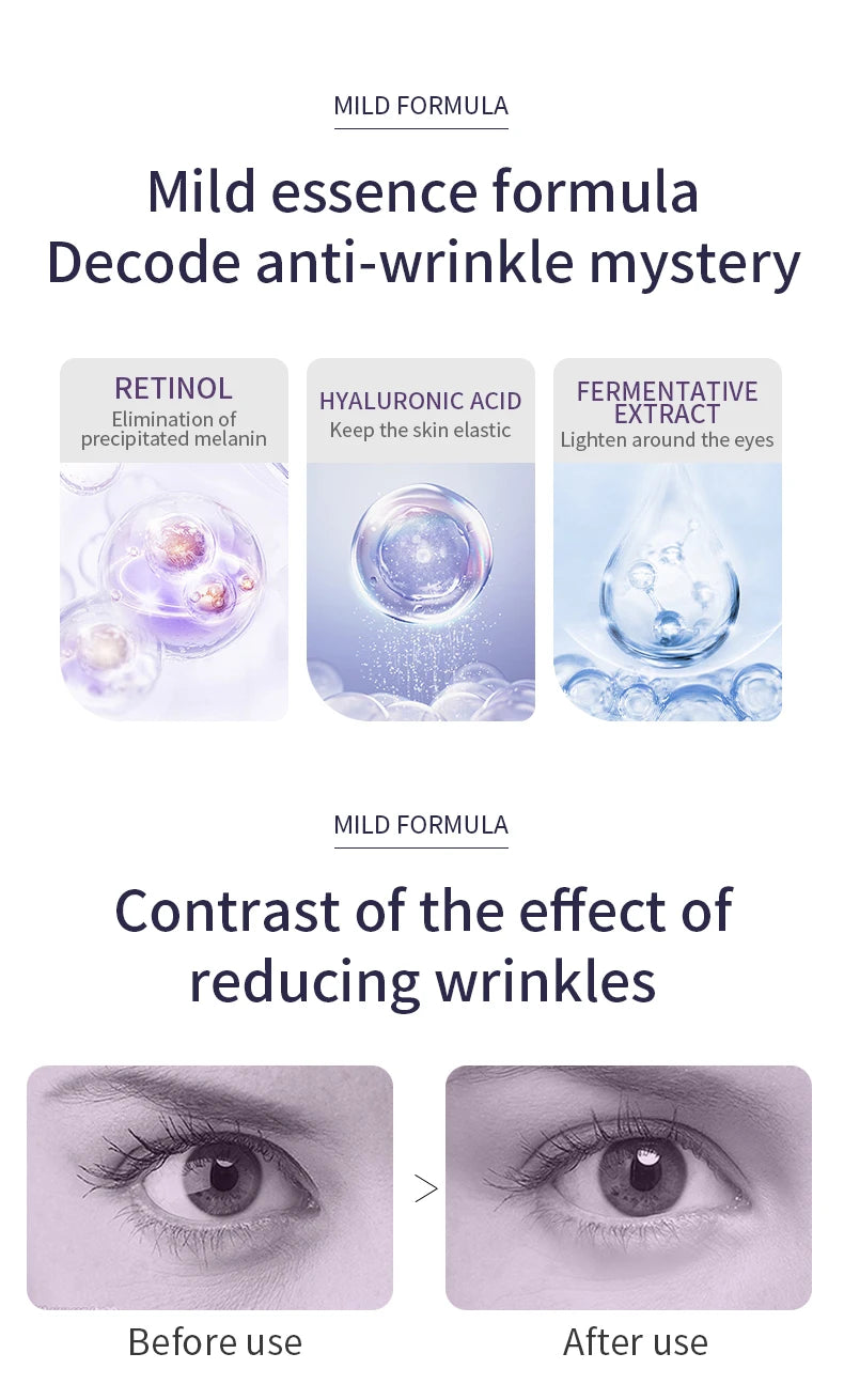 O'CHEAL Anti-rides Anti cernes crème pour les yeux rouleau masseur hydratant sacs pour les yeux Anti-âge acide hyaluronique soins de la peau des yeux